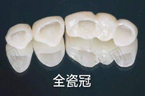 总结：牙齿松动什么原因引起？早发现、选对方法，牙齿能“站稳”！