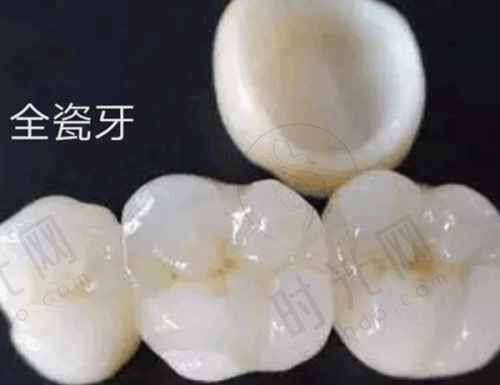三、哪些人适合选？3类人群闭眼入，2类人慎选