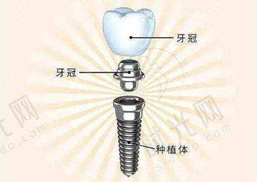 沈阳牙元素口腔医院综合优势与收费背后的保护