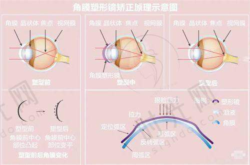 “1.5万和2.78万的全飞秒，怎么选不踩坑？”3步决策法