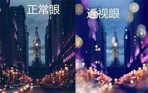 全飞秒需要多少钱？一线城市vs二三线城市价差有多大？