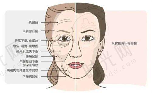 薇旖美胶原蛋白避坑指南：3步走不花冤枉钱