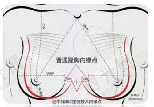 打薇旖美必看避坑点：这5条红线千万别踩！