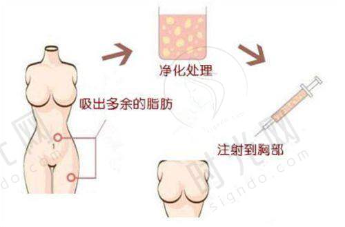 钻石超塑下颌缘有成效吗？真人实例+对比图告诉你答案