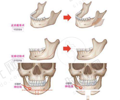 总结