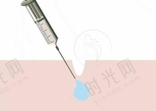 钻石超塑下颌缘做几次成效更好？疗程方案与间隔时间
