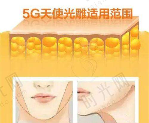 SRT100疤痕放疗为什么复发率低？原理和优势解析
