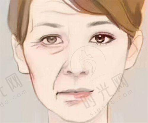 真实实例：28岁白领打薇旖美3次后的肤质变化