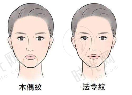 薇旖美胶原蛋白水光针的核心技术有多牛