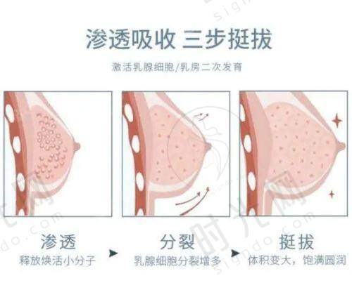 郑州王杨医生眼袋修复卧蚕真的良好吗