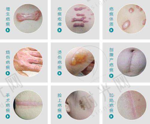 淄博清新微波治狐臭医院的电话