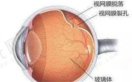 总结