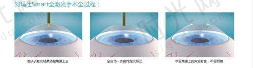 乌鲁木齐普瑞眼科医院项目选择建议