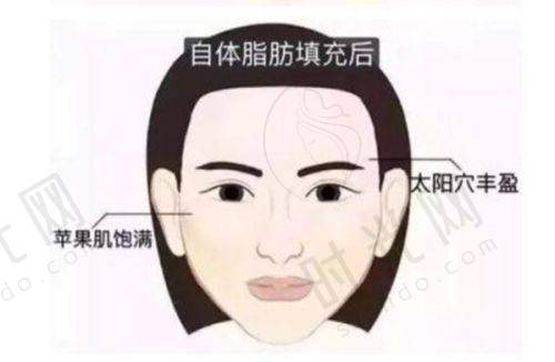 薇旖美三型胶原蛋白多少钱一支？总结：这3个关键点决定你花的钱值不值