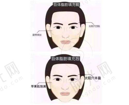 总结