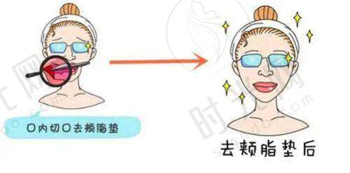 避坑指南：3个“假钻石金雕”特征，新手必看！