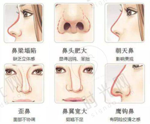 薇旖美胶原蛋白溶液的成效怎么样