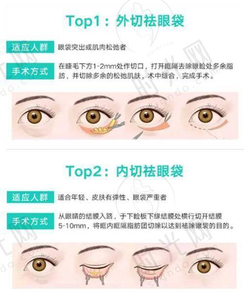 薇旖美价格攻略：如何花更少的钱打对部位？