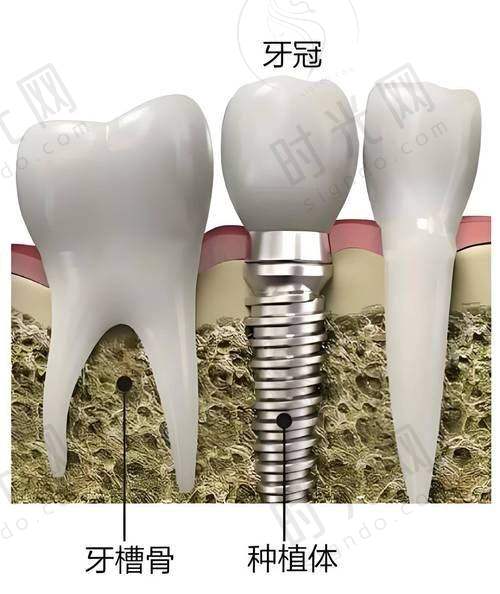 四、总结：大牙松动不可怕，关键是“及时+科学”应对