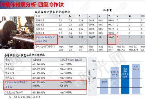 四、不同预算怎么选种植牙?3类人群方案推荐