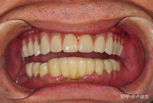 ? 医生资质:普通医生vs主事医师,矫正费用差5000元!