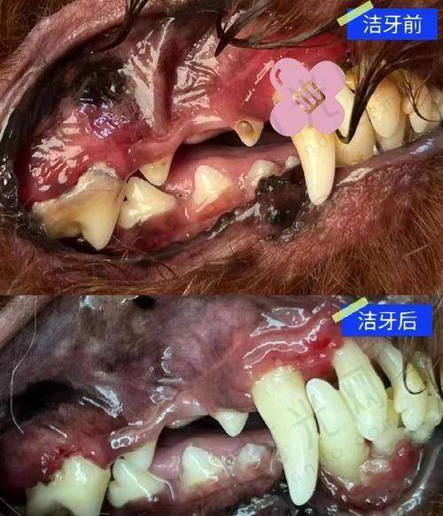 总结：牙周病松动牙，“早治是宝，晚治是草”