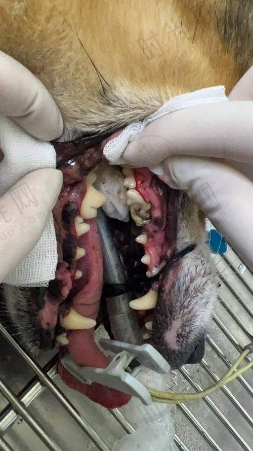 二、牙龈松动修复更简单的3步！在家就能做的基础护理+医院必做治疗