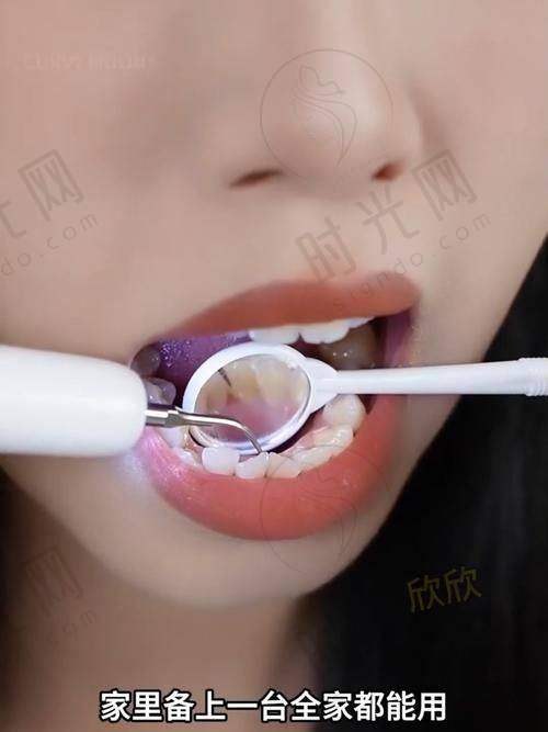 ? 儿童看牙:这些项目医疗保险100%报销!