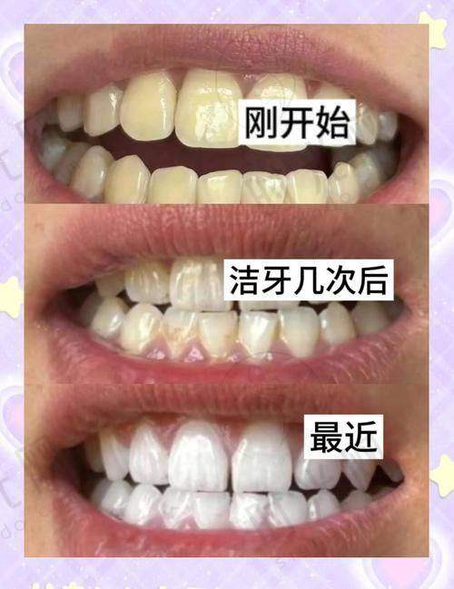 三、关键选择：3个补救方法怎么选？一张表对比优缺点