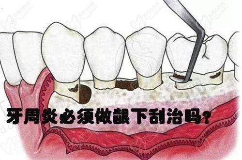总结：五十岁牙齿松动了能修复吗？关键在“早发现、选对治、认真护”