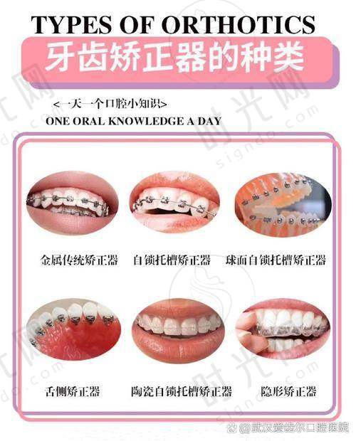 3. 60岁以上老年人：“吃软饭也塞牙”？可能是牙槽骨“变薄”了