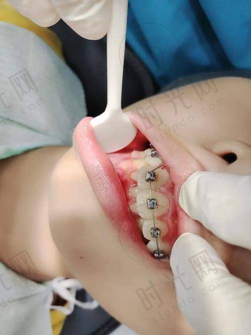 3. 坑点:选医院只看“价格”,不看“医生技术”