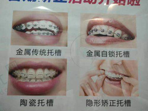三、关键选择指南：3类人群怎么选不踩坑？