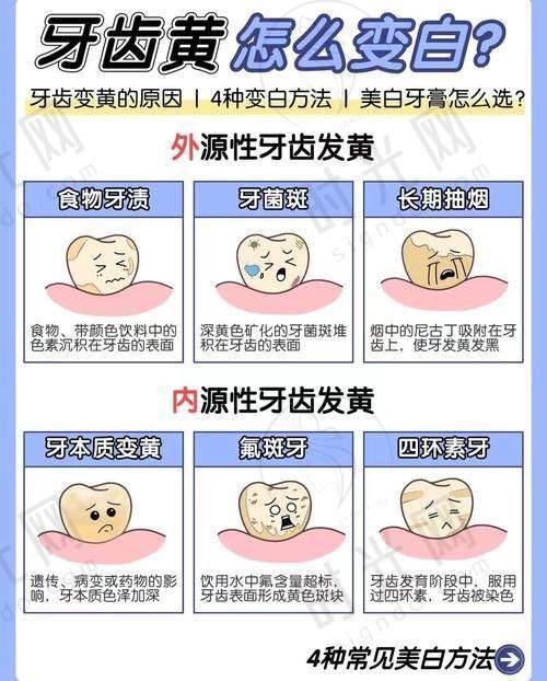 三、日常养护避坑：90%的人都做错了这3件事