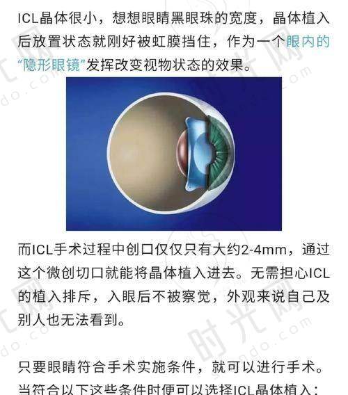 高度近视患者选医院：必须盯紧这4个关键点