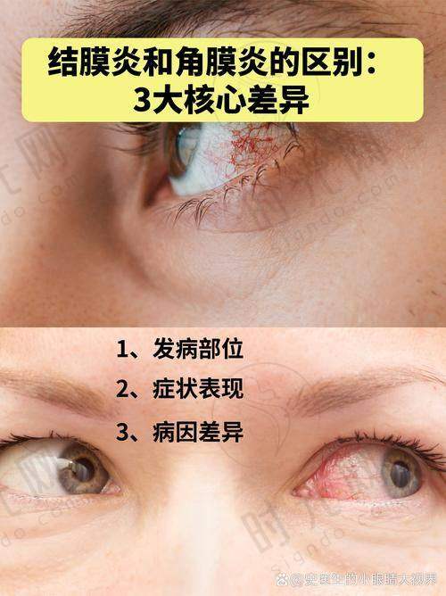 后巩膜葡萄肿会自愈吗?日常做好5件事,延缓病变不踩雷