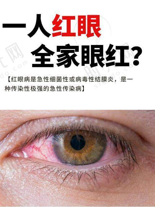 后巩膜葡萄肿会自愈吗?不想视力恶化,这3类治疗手段要知道