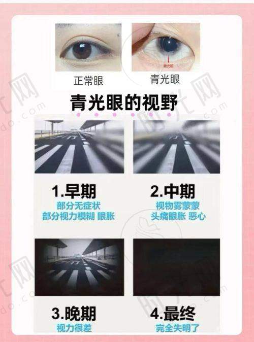 家长必看:后巩膜加固术后护理避坑指南