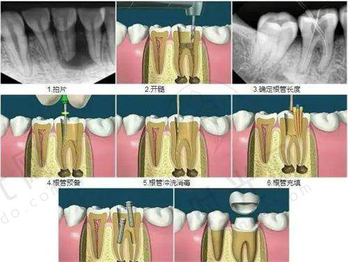 中山大学光华口腔医学校附属口腔医院诊疗项目
