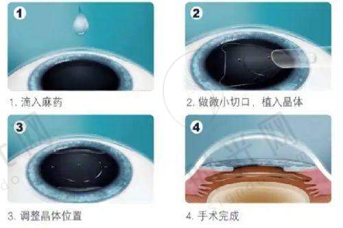 广西医 科 大学附属第一医院眼科口碑探秘