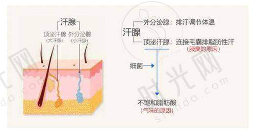 阴道紧缩针的适用人群和禁忌人群