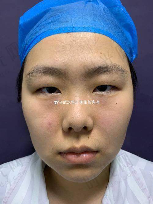 上海伊莱美整形医院是国有的吗？