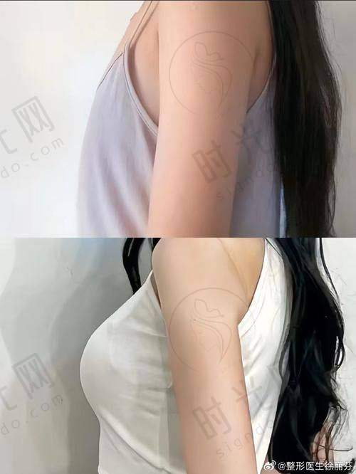上海伊莱美整形医院特色技术及服务