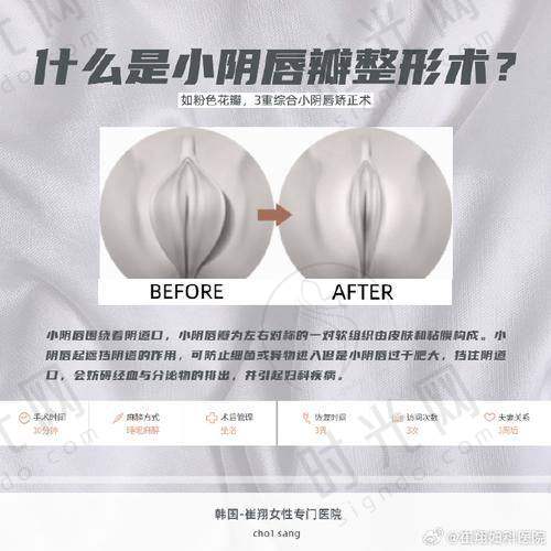 自体脂肪增粗真实感受：患者术后生活有何改变？