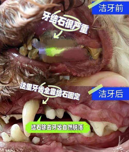 北京大学人民医院口腔科预约挂号