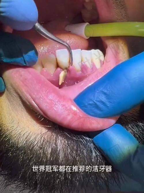 北京大学人民医院口腔科地址电话