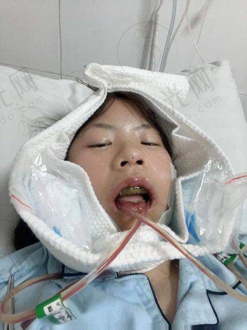 北京大学口腔医院预约挂号