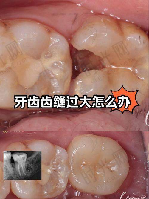 暨南大学附属第一医院口腔科预约挂号