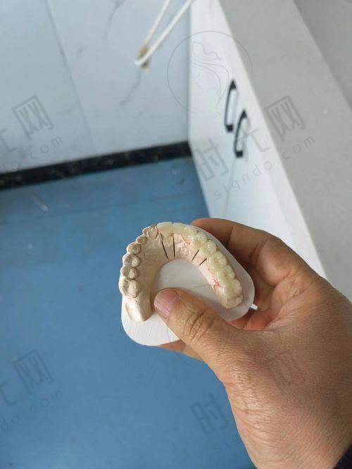 北京大学口腔医院诊疗项目