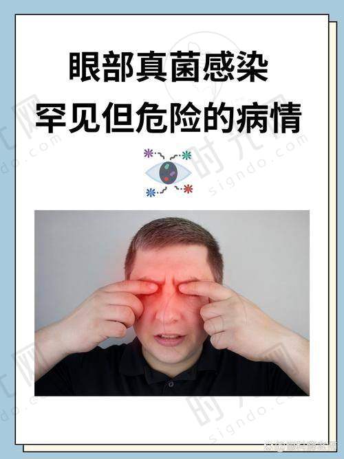 ### 后巩膜加固术大概费用2025年全新行情：一线城市1.68W起，二三线城市低至4880元但有“隐藏成本”